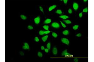 Immunofluorescence of monoclonal antibody to CAMK2A on HeLa cell. (CAMK2A antibody  (AA 305-410))