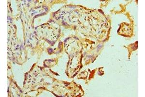 Immunohistochemistry of paraffin-embedded human placenta tissue using ABIN7142463 at dilution of 1:100 (ABAT antibody  (AA 29-300))