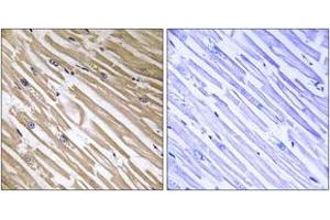 Immunohistochemistry analysis of paraffin-embedded human heart tissue, using NDRG4 Antibody.
