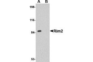 Western Blotting (WB) image for anti-Regulating Synaptic Membrane Exocytosis 2 (RIMS2) (Middle Region) antibody (ABIN1031067) (RIMS2 antibody  (Middle Region))