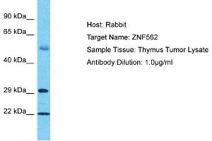 Host: Rabbit Target Name: ZNF562 Sample Tissue: Human Thymus Tumor Antibody Dilution: 1ug/ml (ZNF562 antibody  (C-Term))