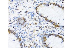 Immunohistochemistry of paraffin-embedded Human appendix using DDX39B Polyclonal Antibody at dilution of 1:100 (40x lens).