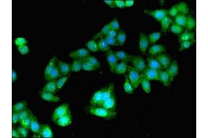 Immunofluorescent analysis of HepG2 cells using ABIN7154773 at dilution of 1:100 and Alexa Fluor 488-congugated AffiniPure Goat Anti-Rabbit IgG(H+L) (GBP2 antibody  (AA 100-259))