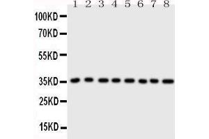 Western Blotting (WB) image for anti-Annexin A3 (ANXA3) (AA 124-141), (Middle Region) antibody (ABIN3043176) (Annexin A3 antibody  (Middle Region))