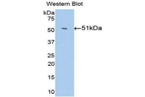 Western Blotting (WB) image for anti-Serpin Family C Member 1 (SERPINC1) (AA 159-258) antibody (ABIN3201708) (SERPINC1 antibody  (AA 159-258))