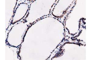 Image no. 6 for anti-Sequestosome 1 (SQSTM1) antibody (ABIN1499989) (SQSTM1 antibody)