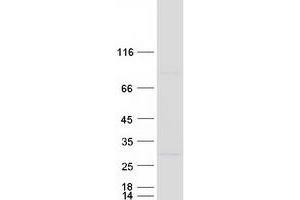 Western Blotting (WB) image for L(3)mbt-Like 3 (L3MBTL3) (Transcript Variant 2) protein (Myc-DYKDDDDK Tag) (ABIN2724448)