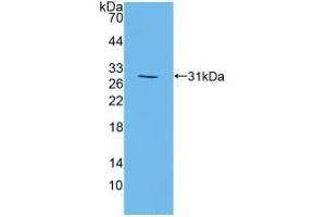 Detection of Recombinant MAPK7, Mouse using Polyclonal Antibody to Mitogen Activated Protein Kinase 7 (MAPK7)
