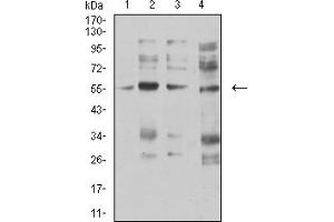 Western blot analysis using CHRNA5 mouse mAb against membrane protein lysate of C6 (1), membrane protein lysate of SK-N-SH (2), membrane protein lysate of C6 (3), and C6 (4) cell lysate.