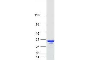 Validation with Western Blot (GSTO1 Protein (Myc-DYKDDDDK Tag))
