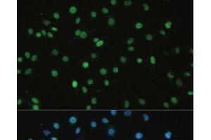 Immunofluorescence analysis of C6 cells using SET Polyclonal Antibody at dilution of 1:100. (SET/TAF-I antibody)