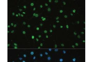 Immunofluorescence analysis of C6 cells using SET Polyclonal Antibody at dilution of 1:100.