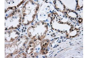 Immunohistochemical staining of paraffin-embedded Kidney tissue using anti-ATP5B mouse monoclonal antibody. (ATP5B antibody)