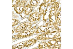 Immunohistochemistry (IHC) image for anti-TANK-Binding Kinase 1 (TBK1) (AA 440-729) antibody (ABIN3016268)