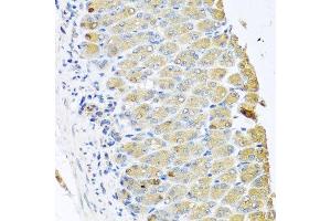 Immunohistochemistry of paraffin-embedded mouse stomach using OGFR antibody at dilution of 1:100 (x40 lens). (OGFR antibody)