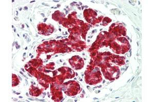 Human Breast: Formalin-Fixed, Paraffin-Embedded (FFPE)