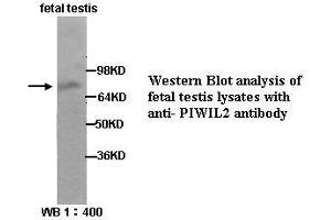 Image no. 1 for anti-Piwi-Like 2 (PIWIL2) (Internal Region) antibody (ABIN790870) (PIWIL2 antibody  (Internal Region))