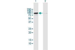Western Blot analysis of RIOK1 expression in transfected 293T cell line by RIOK1 MaxPab polyclonal antibody. (RIOK1 antibody  (AA 1-568))
