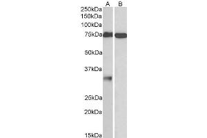 ABIN571279 (1µg/ml) staining of Human Cerebellum (A) and Olfactory Bulb (B) lysates (35µg protein in RIPA buffer). (GPM6A antibody  (Internal Region))