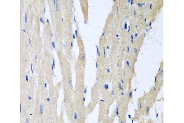 PITRM1 antibody