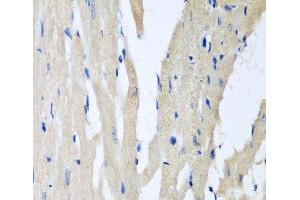 Immunohistochemistry of paraffin-embedded Rat heart using PITRM1 Polyclonal Antibody at dilution of 1:100 (40x lens).