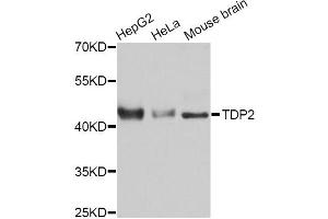Western blot analysis of extracts of various cell lines, using TDP2 Antibody.
