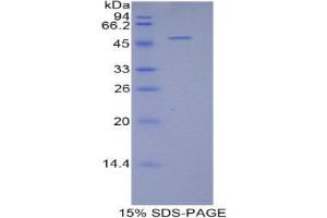 SDS-PAGE (SDS) image for BCL2-Like 2 (BCL2L2) (AA 2-193) protein (His tag) (ABIN2120635)