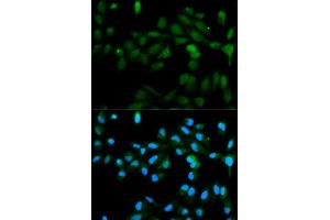 Immunofluorescence analysis of MCF7 cell using CYP11A1 antibody. (CYP11A1 antibody)
