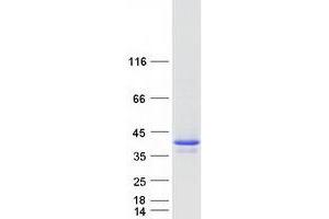 Western Blotting (WB) image for Baculoviral IAP Repeat-Containing 7 (BIRC7) (Transcript Variant 2) protein (Myc-DYKDDDDK Tag) (ABIN2715279)