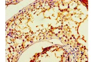 Immunohistochemistry of paraffin-embedded human testis tissue using CHRFAM7A Antibody at a dilution of 1:100. (CHRFAM7A antibody  (AA 1-150))