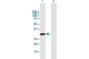Western Blot analysis of ADAL expression in transfected 293T cell line by ADAL MaxPab polyclonal antibody. (ADAL antibody  (AA 1-267))