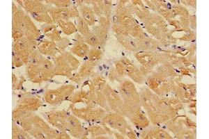 Immunohistochemistry of paraffin-embedded human heart tissue using ABIN7173569 at dilution of 1:100 (TNNC1 antibody  (AA 11-149))