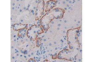Immunohistochemistry (IHC) image for anti-Sodium Channel, Nonvoltage-Gated 1, gamma (SCNN1G) (AA 1-182) antibody (ABIN1870655)
