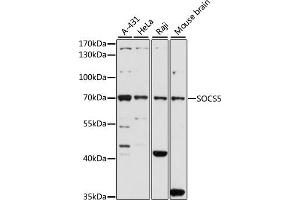 Western blot analysis of extracts of various cell lines, using SOCS5 antibody (ABIN6128734, ABIN6148271, ABIN6148272 and ABIN6223959) at 1:1000 dilution. (SOCS5 antibody  (AA 1-140))
