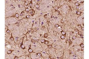 Paraformaldehyde-fixed, paraffin embedded Mouse brain Antigen retrieval by boiling in sodium citrate buffer (pH6. (ALOX5 antibody  (AA 601-674))