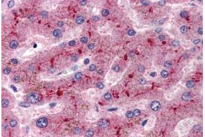 Human Liver (formalin-fixed, paraffin-embedded) stained with CFH antibody ABIN337307 at 2. (Complement Factor H antibody  (AA 577-588))
