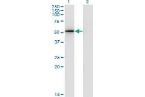 Western Blot analysis of PSMD4 expression in transfected 293T cell line by PSMD4 monoclonal antibody (M01), clone 3C9. (PSMD4/ASF antibody  (AA 1-110))