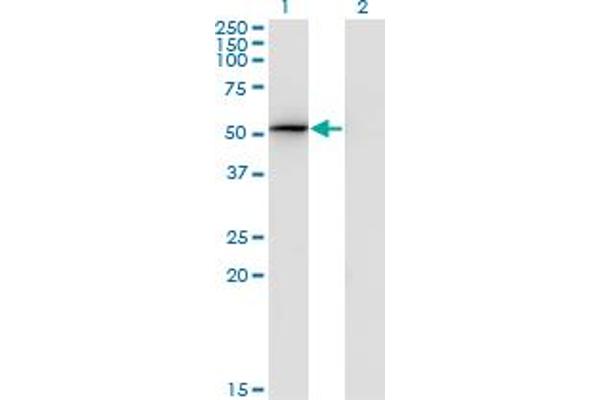 PSMD4/ASF anticorps  (AA 1-110)