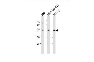 All lanes : Anti-ENT1(Slc29a1)-Ps254 at 1:500-1000 dilution Lane 1: 293 whole cell lysate Lane 2: MDA-MB-453 whole cell lysate Lane 3: Mouse lung tissue lysate Lysates/proteins at 20 μg per lane. (SLC29A1 antibody  (AA 232-260))