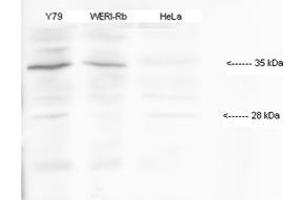 Human; HMX1 antibody - middle region validated by WB using Y79, WERI-(human retinoblastoma cell lines), HeLa-(human papilloma virus cell line) at 1:1000. (HMX1 antibody  (Middle Region))