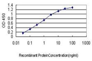 Detection limit for recombinant GST tagged ANKRA2 is approximately 0. (ANKRA2 antibody  (AA 1-98))