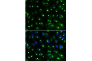 Immunofluorescence analysis of MCF-7 cells using GGA2 antibody. (GGA2 antibody)