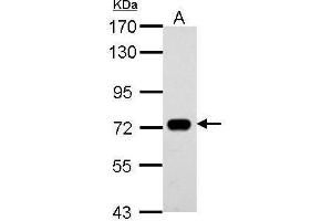 WB Image Sample (30 ug of whole cell lysate) A: THP-1 7. (SAMHD1 antibody  (Internal Region))