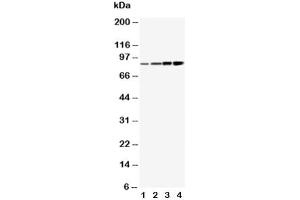 Western blot testing of PI3K antibody and Lane 1:  MCF-7 (PIK3R1 antibody  (AA 65-80))