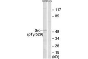 Western blot analysis of extracts from COS7 cells treated with PMA 125ng/ml 30', using Src (Phospho-Tyr529) Antibody.