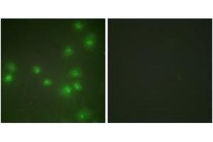 Immunofluorescence analysis of HuvEc cells, using ZNF265 Antibody. (ZNF265 antibody  (AA 106-155))