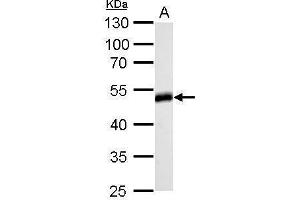 WB Image Homer antibody detects HOMER1 protein by Western blot analysis. (HOMER1 antibody  (Center))