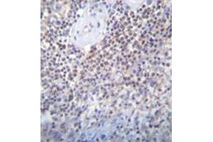 Immunohistochemistry analysis in formalin fixed and paraffin embedded human spleen tissue reacted with PATL2 Antibody (Center) followed which was peroxidase conjugated to the secondary antibody and followed by DAB staining. (PATL2 antibody  (Middle Region))