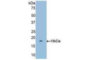 Western blot analysis of recombinant Human RBP1. (RBP1 antibody  (AA 2-135))