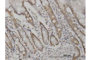 Image no. 2 for anti-V-Akt Murine Thymoma Viral Oncogene Homolog 2 (AKT2) (AA 100-189) antibody (ABIN599349) (AKT2 antibody  (AA 100-189))